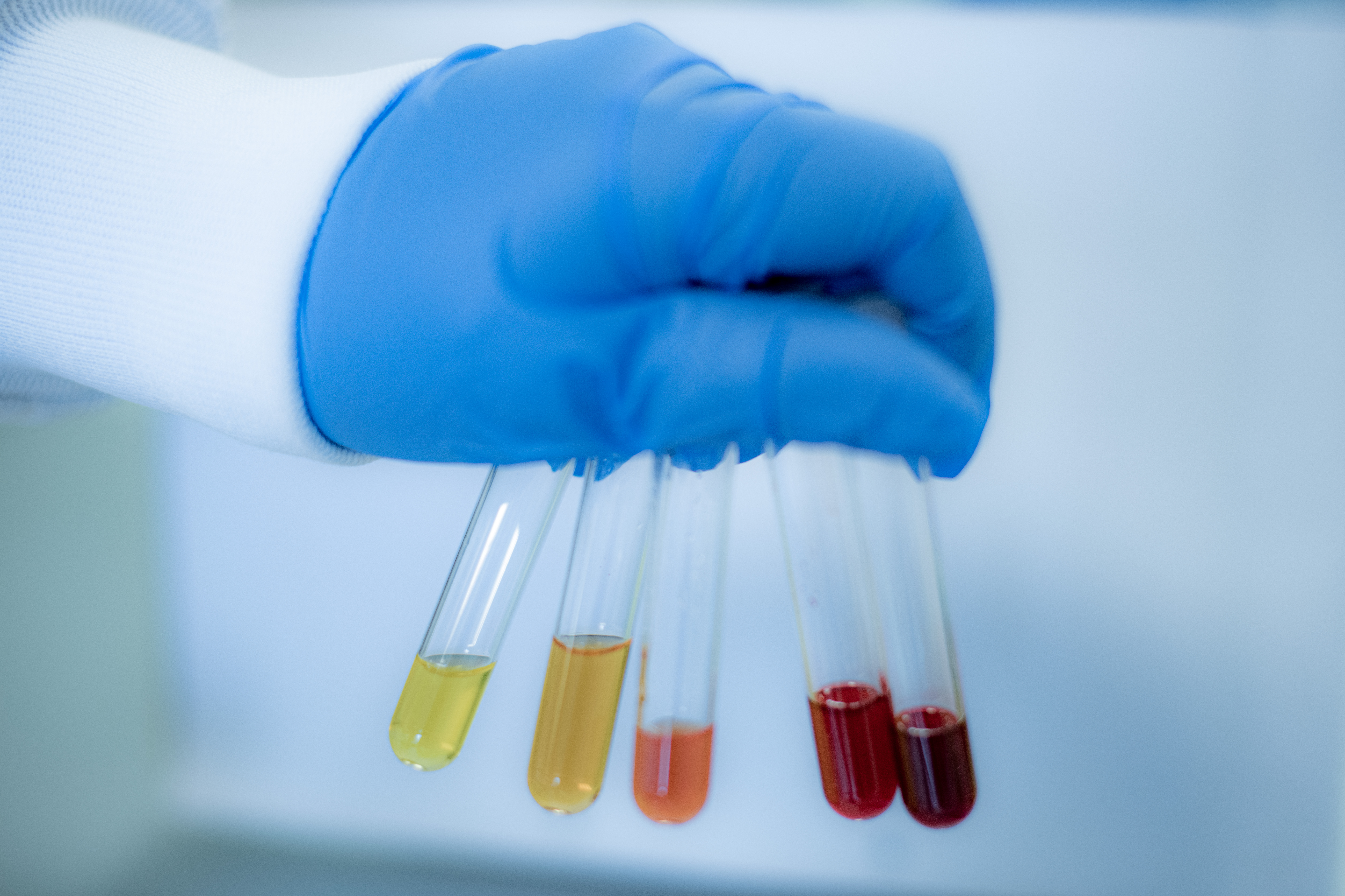 Präanalytik bei der Blutentnahme für aussagekräftige labormedizinische Befunde